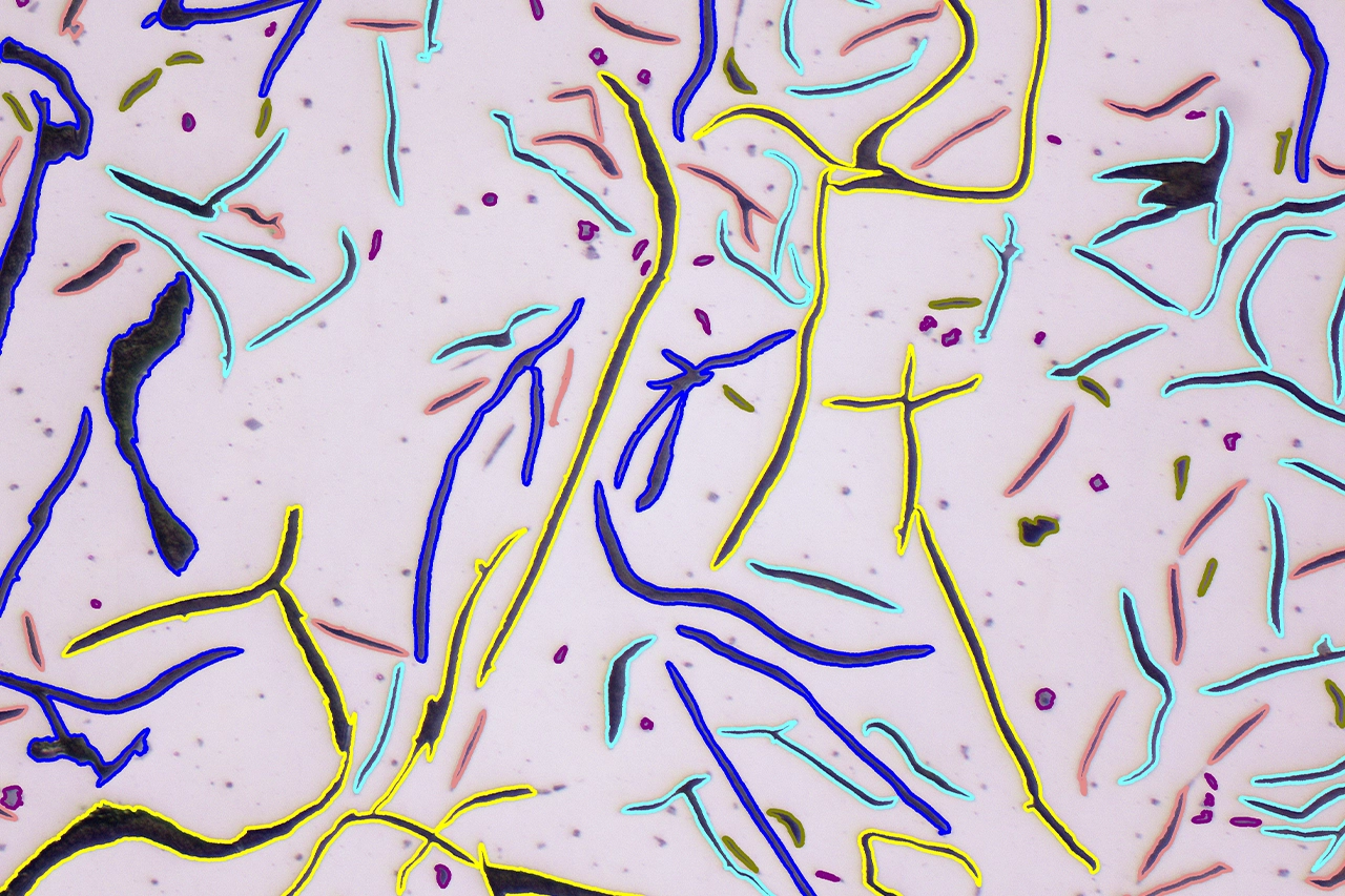 MIB ensaio de tracao - ensaio metalografico